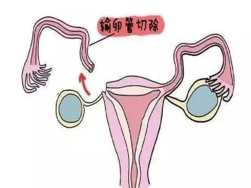 嘉兴供卵试管自怀流程,广州供卵助孕机构