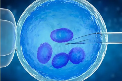 宫腔内人工授精：现代医学的生育奇迹